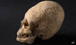 elongated-skull-france